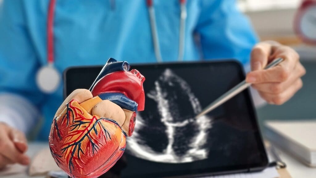 7 Key Facts About Mitral Valve Ring Annuloplasty: Quick Expert Insights
