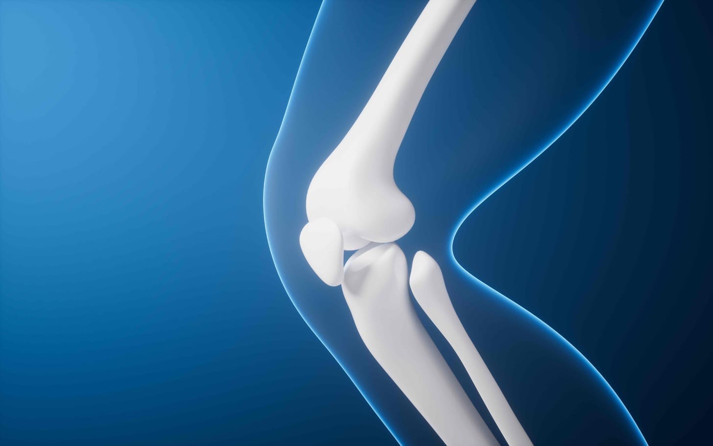 What Is Osseous Metastatic Disease and How Does It Affect the Bones?