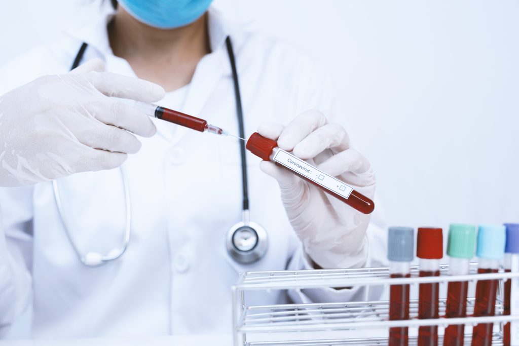 RBC Blood Test