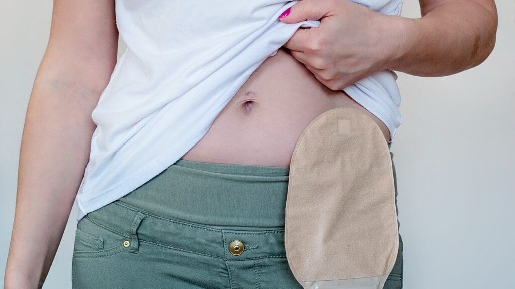 prostate milking benefits