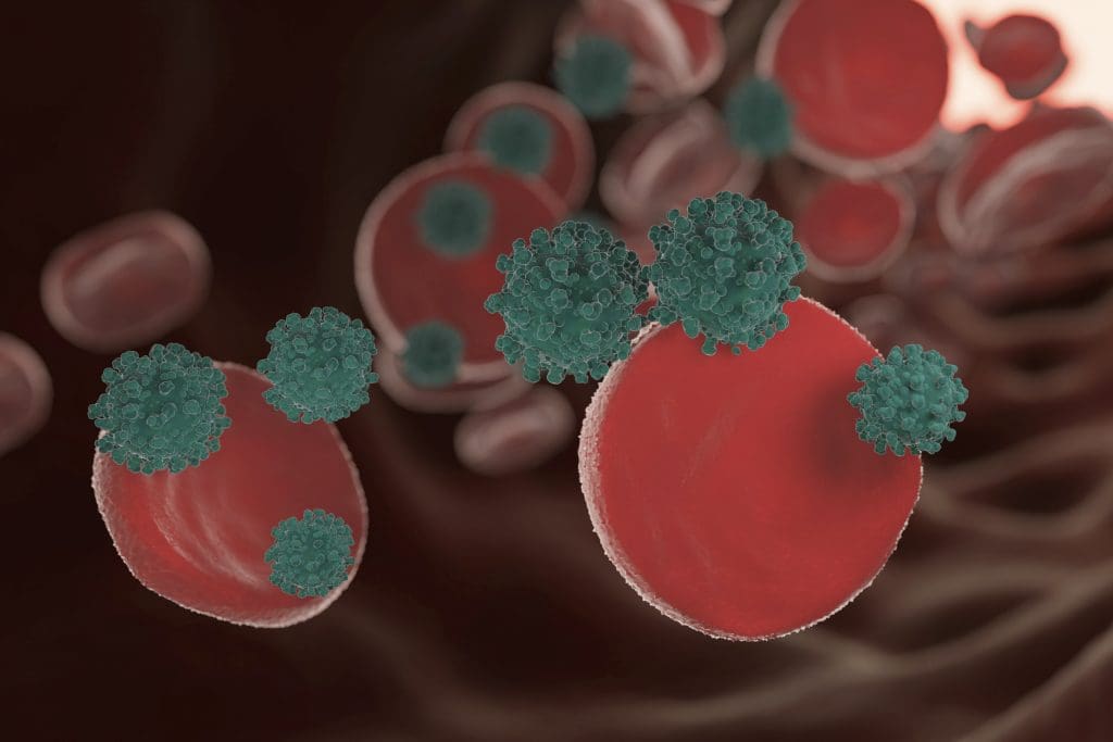 Thalassemia Cause Leg Pain