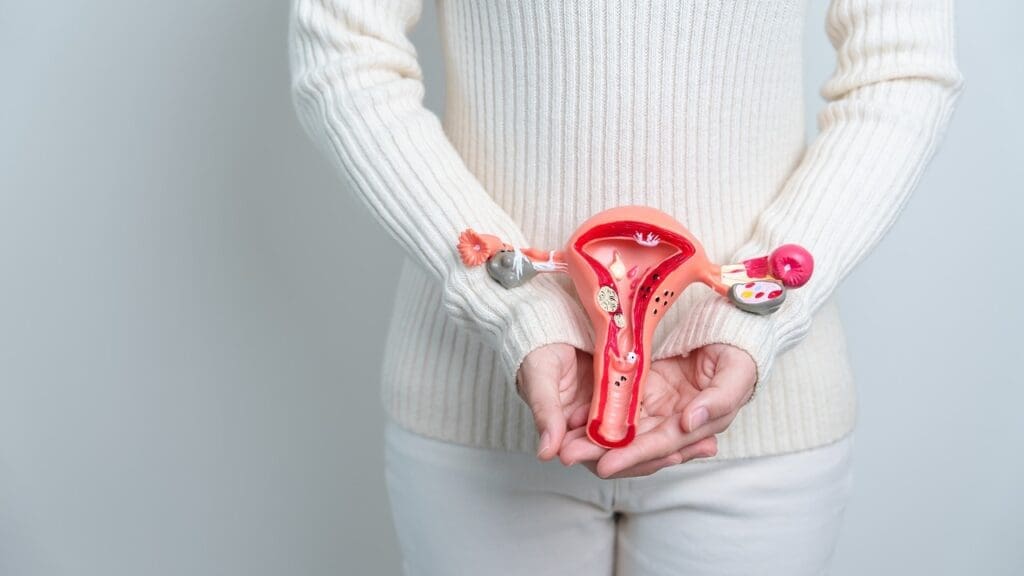 What Causes Ovarian Cancer