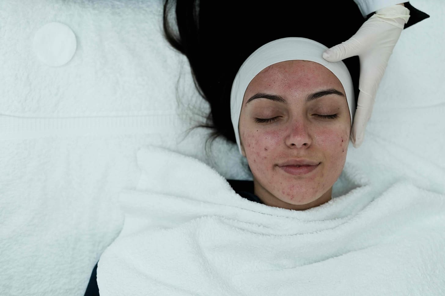 How to Remove Skin Cancer on the Face: Surgical Options and What to Expect