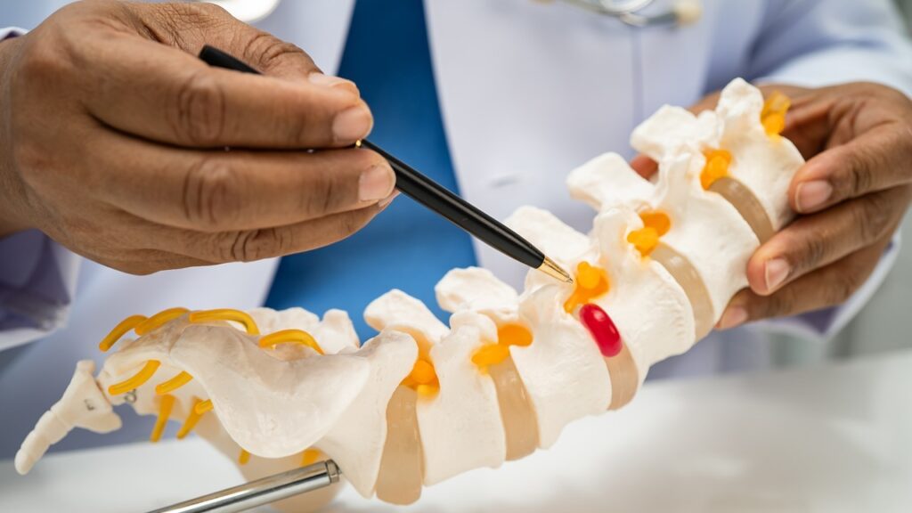 spinal cage longevity spinal cage longevity