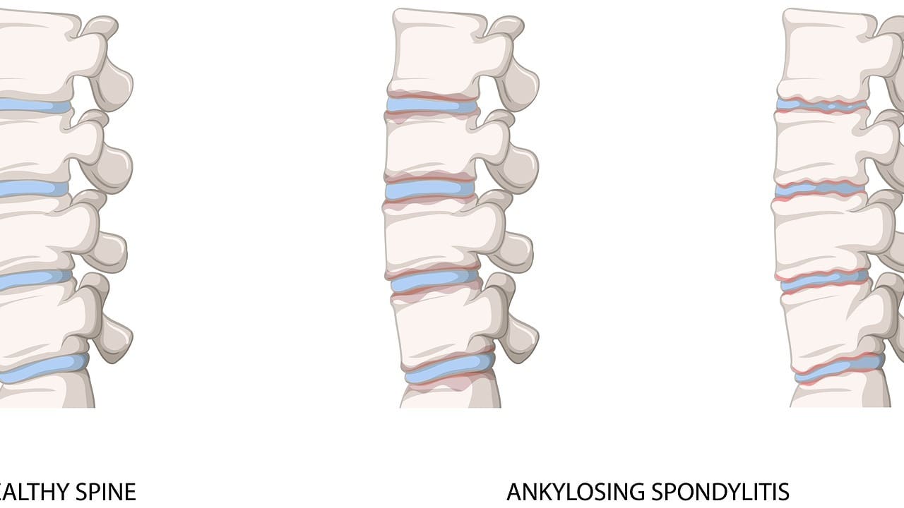 7 Spinal Cord Injury Types and Levels: Guide to SCI Function and Symptoms