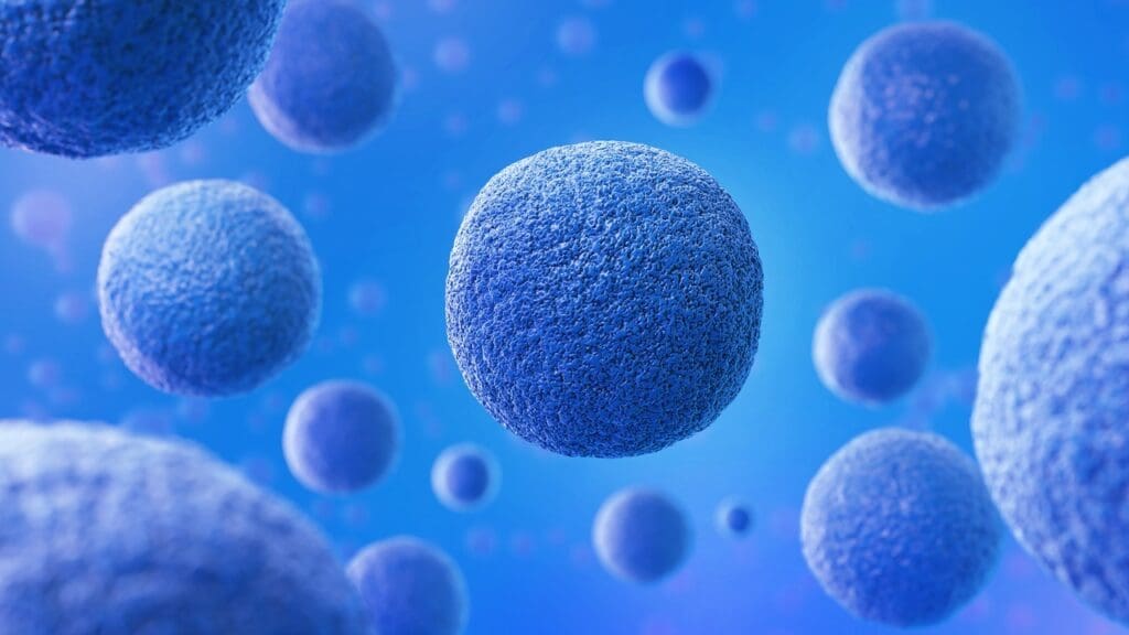 stage iiia dlbcl stage iiia dlbcl