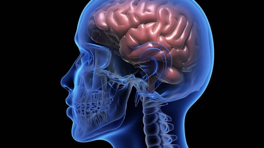 swollen brain symptoms