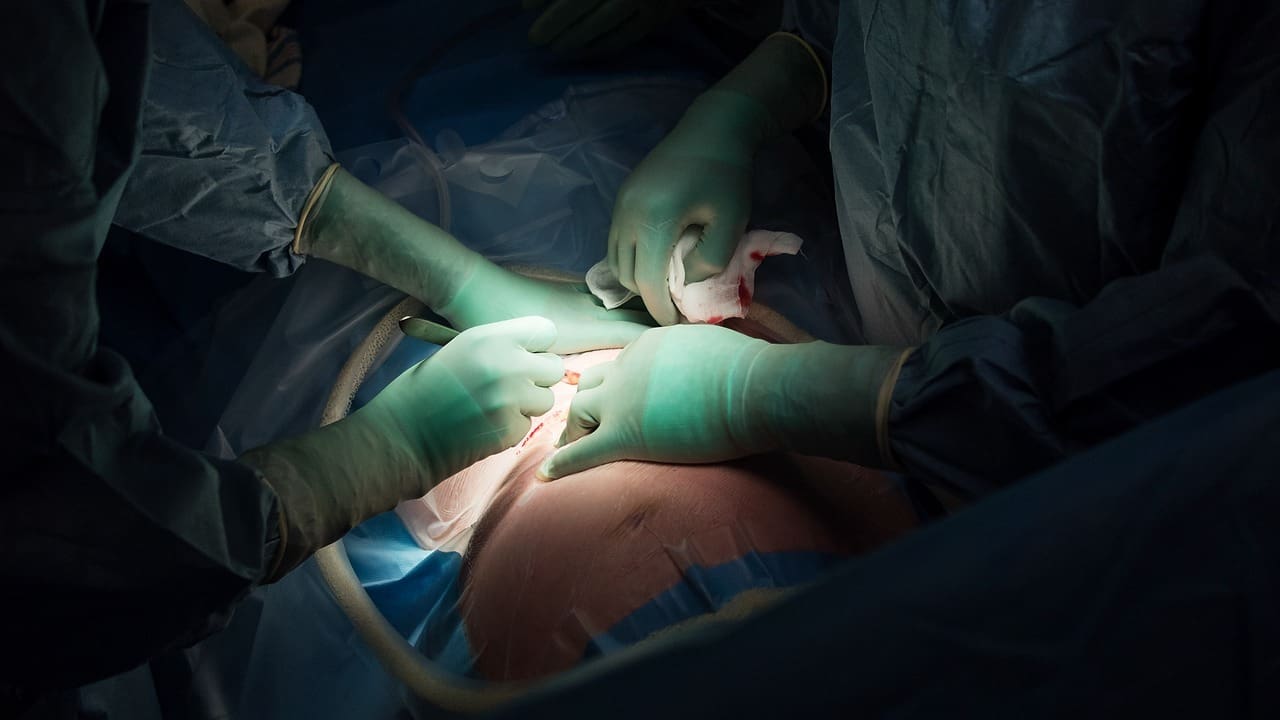 What Is Triple A Repair Surgery and How Is an AAA Procedure Performed?