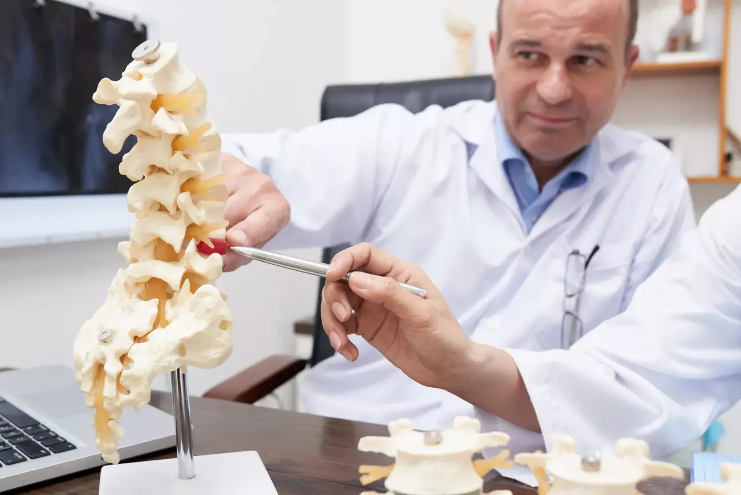 Two Level Fusion Cervical Spine: 7 Key Facts About Surgery and Recovery