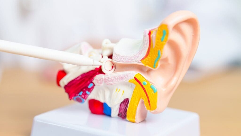 vestibular schwannoma vestibular schwannoma