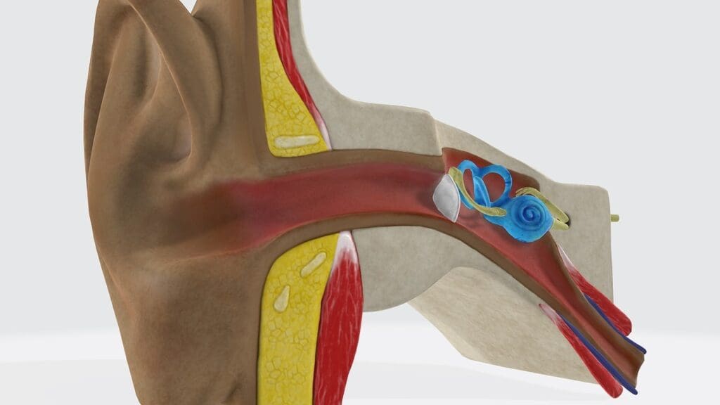 vestibular schwannoma risk factors vestibular schwannoma risk factors