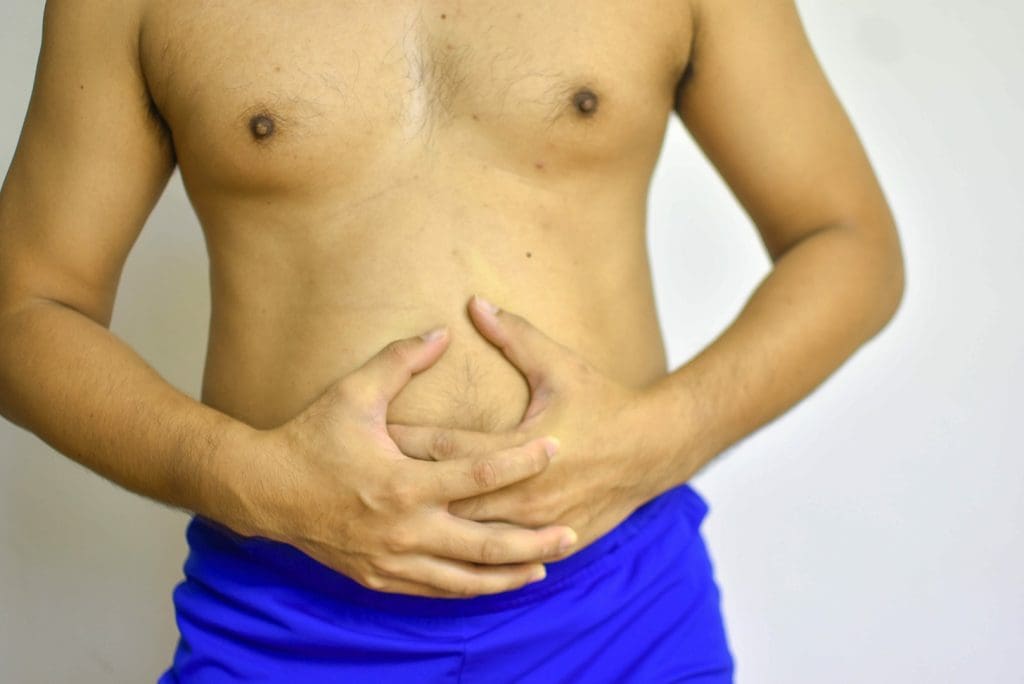 view of a human abdomen, showcasing a bloated, distended stomach with visible discoloration and swelling
