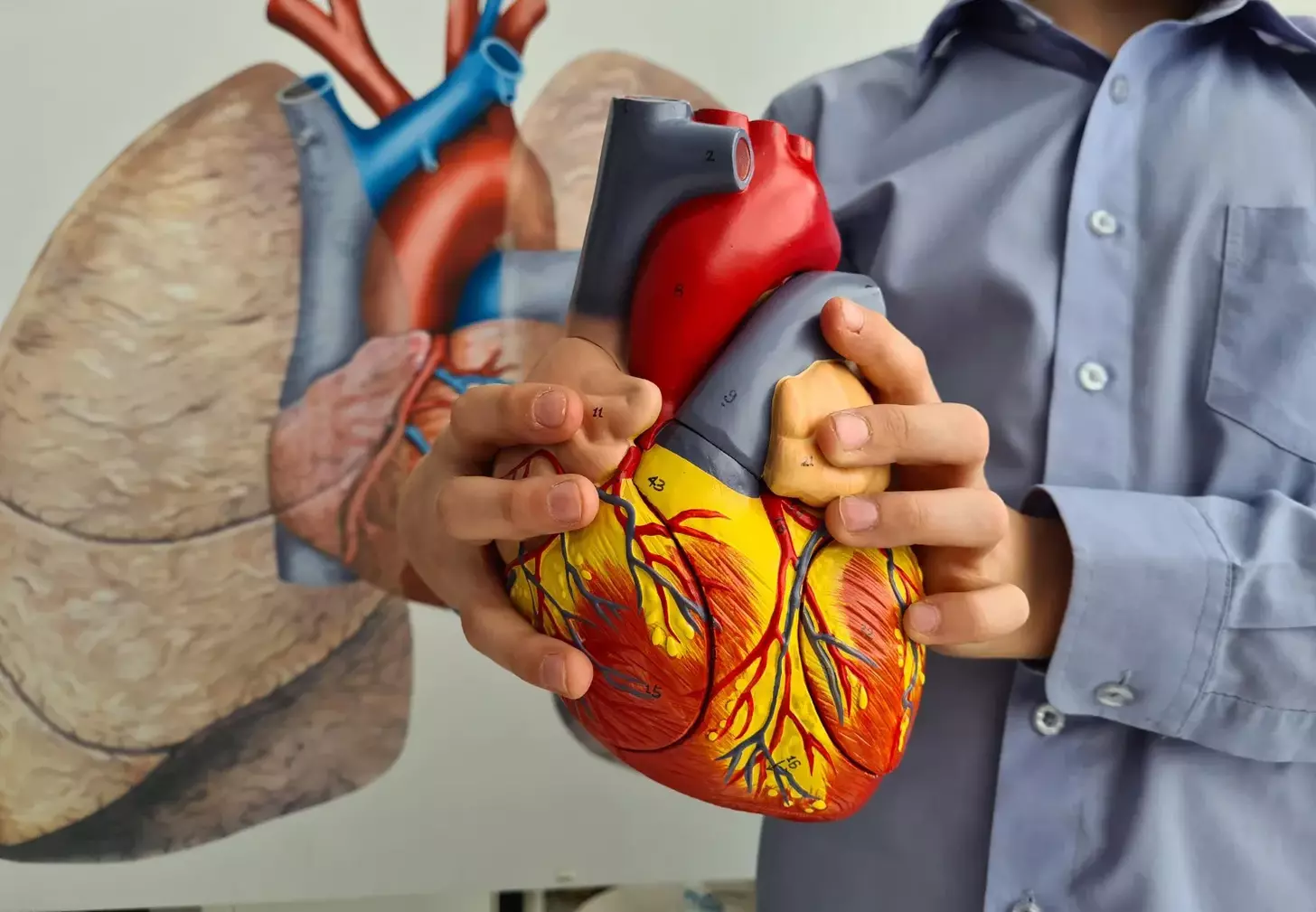 What Does MI Mean in Medical Terms and How Is It Linked to Heart Attack (Myocardial Infarction)?