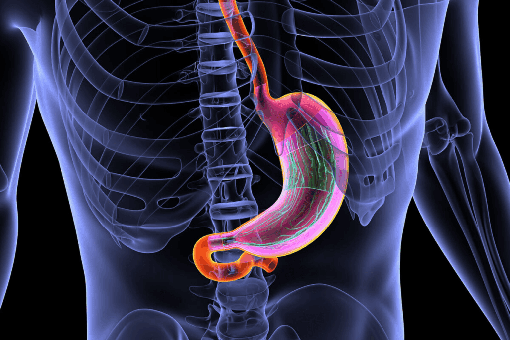 Gastric Ulcer Back Pain: 5 Alarming Signs