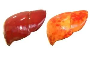 Liver: Amazing Ways To Protect Your Vital Organ