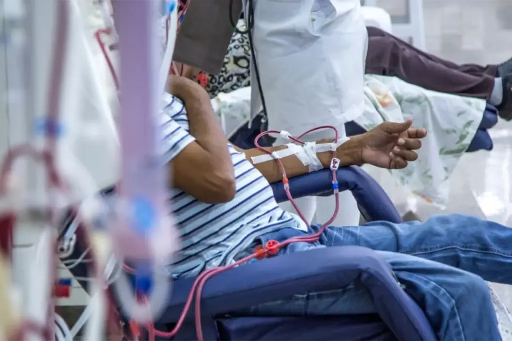 Types of Vascular Access for Hemodialysis