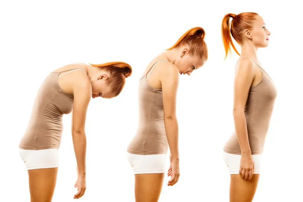 Deformity Correction Before and After